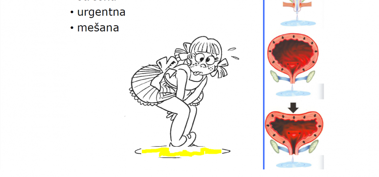 Urinska inkontinenca